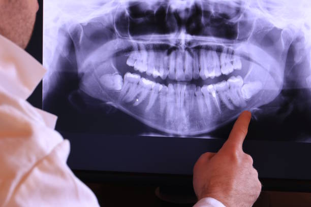 Best Emergency Gum Treatment in Glassmanor, MD