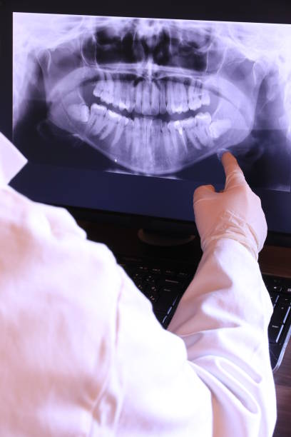 Best Emergency Dental Care for Broken or Chipped Teeth in Glassmanor, MD