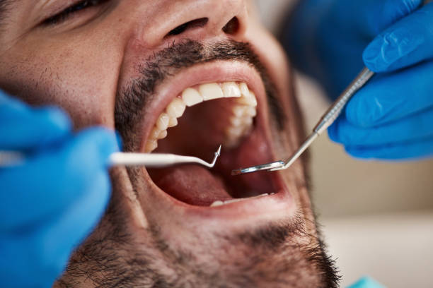  Glassmanor, MD Emergency Dentist Pros